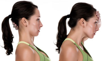 forward-head-posture